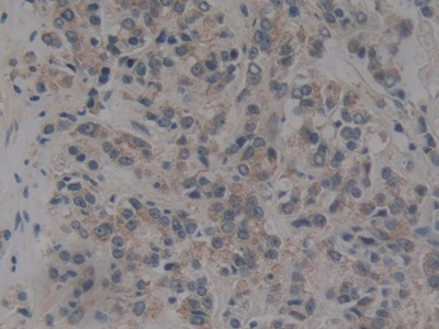 Polyclonal Antibody to Nucleoporin 153 (NUP153)