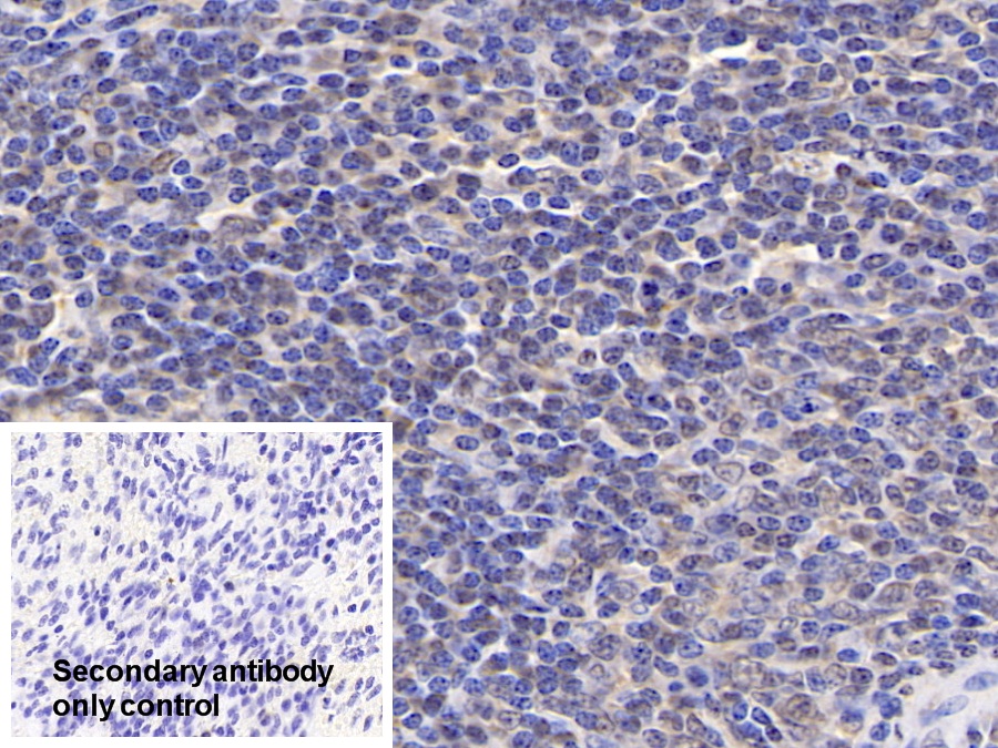 Polyclonal Antibody to Phospholipase A1 (PLA1)