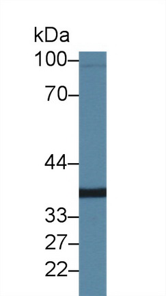 Polyclonal Antibody to Phospholipase A1 (PLA1)