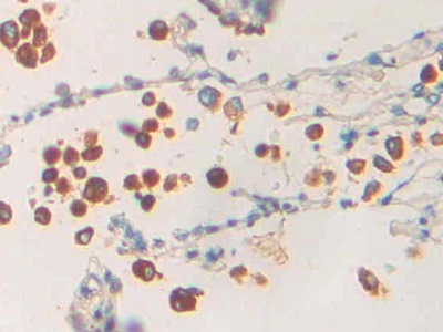 Polyclonal Antibody to Phospholipase A1 (PLA1)