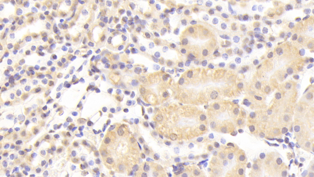 Polyclonal Antibody to Nucleoporin 133 (NUP133)