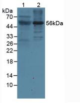 Polyclonal Antibody to Leukocyte Immunoglobulin Like Receptor Subfamily B, Member 2 (LILRB2)