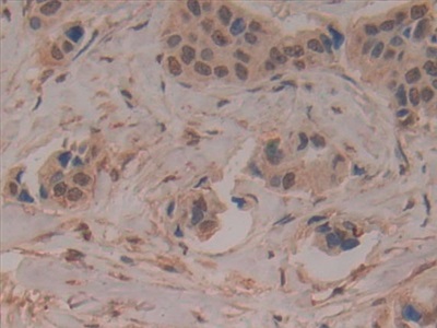 Polyclonal Antibody to Leukocyte Immunoglobulin Like Receptor Subfamily B, Member 2 (LILRB2)