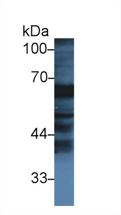 Polyclonal Antibody to Fibrinogen Alpha Chain (FGA)