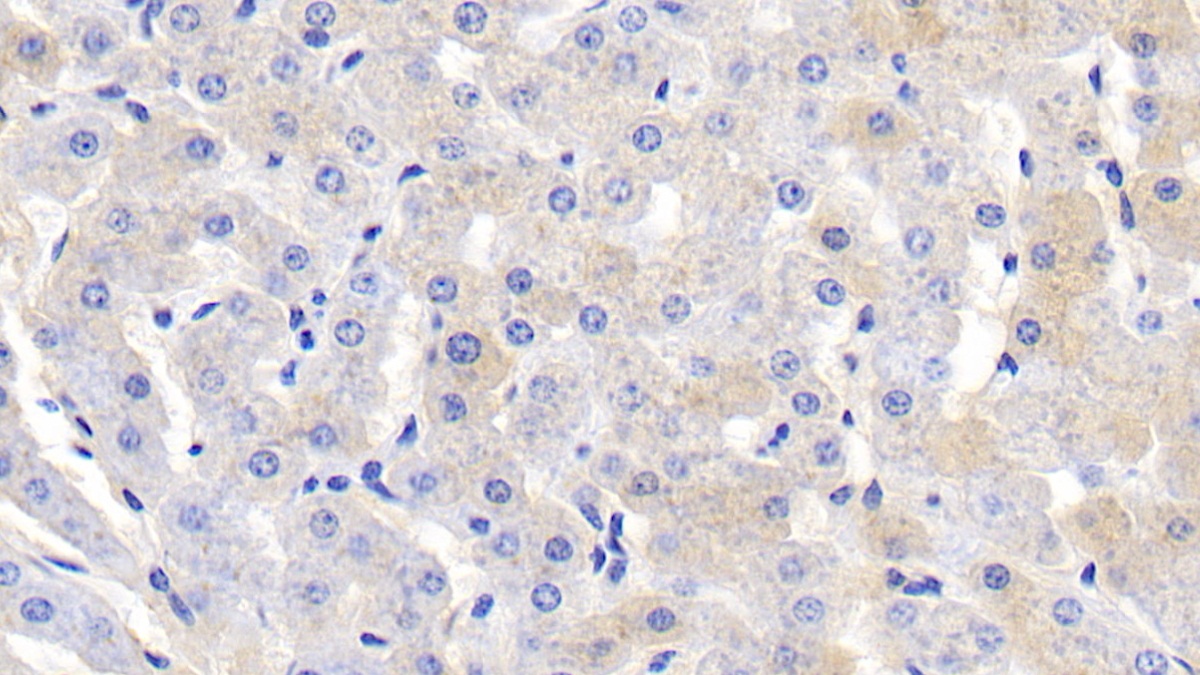 Polyclonal Antibody to Fibrinogen Alpha Chain (FGA)