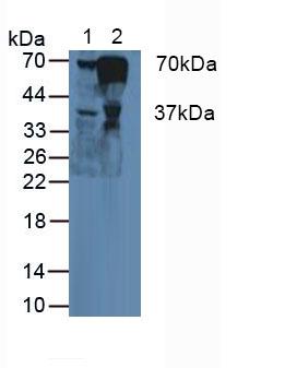 Polyclonal Antibody to Fibrinogen Alpha Chain (FGA)