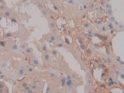 Polyclonal Antibody to Fibrinogen Alpha Chain (FGA)