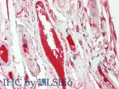 Polyclonal Antibody to Fibrinogen Alpha Chain (FGA)