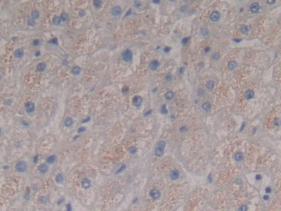 Polyclonal Antibody to Fibrinogen Alpha Chain (FGA)