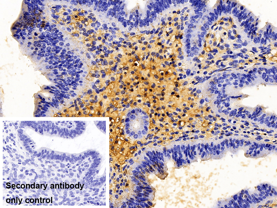 Polyclonal Antibody to Fibrinogen Alpha Chain (FGA)