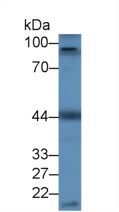 Polyclonal Antibody to Fibrinogen Alpha Chain (FGA)