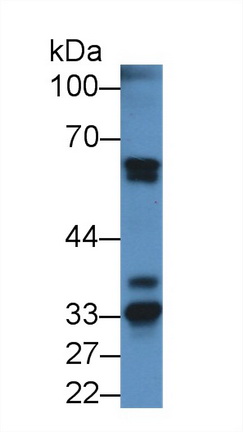 Polyclonal Antibody to Fibrinogen Alpha Chain (FGA)