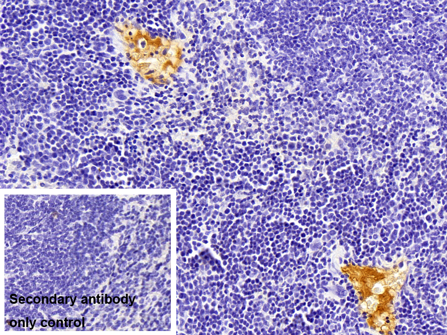 Polyclonal Antibody to Fibrinogen Alpha Chain (FGA)