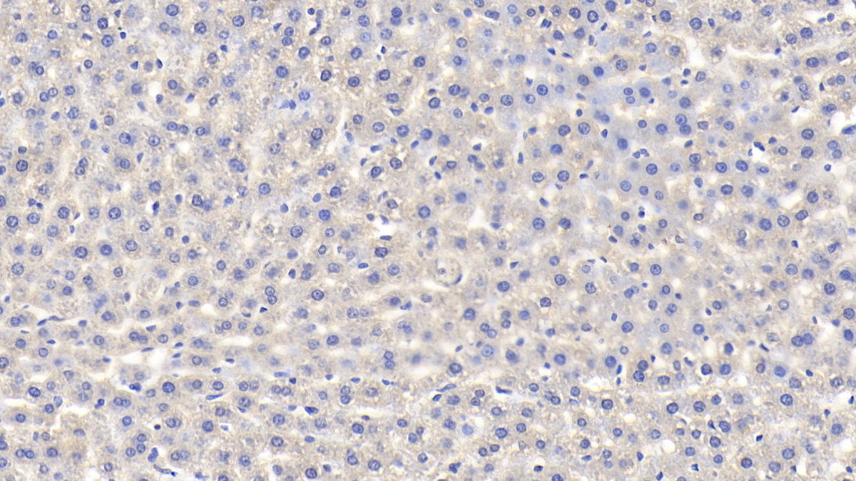 Polyclonal Antibody to Fibrinogen Alpha Chain (FGA)