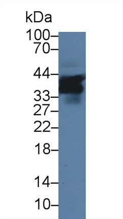 Polyclonal Antibody to Signaling Lymphocytic Activation Molecule Family, Member 5 (SLAMF5)