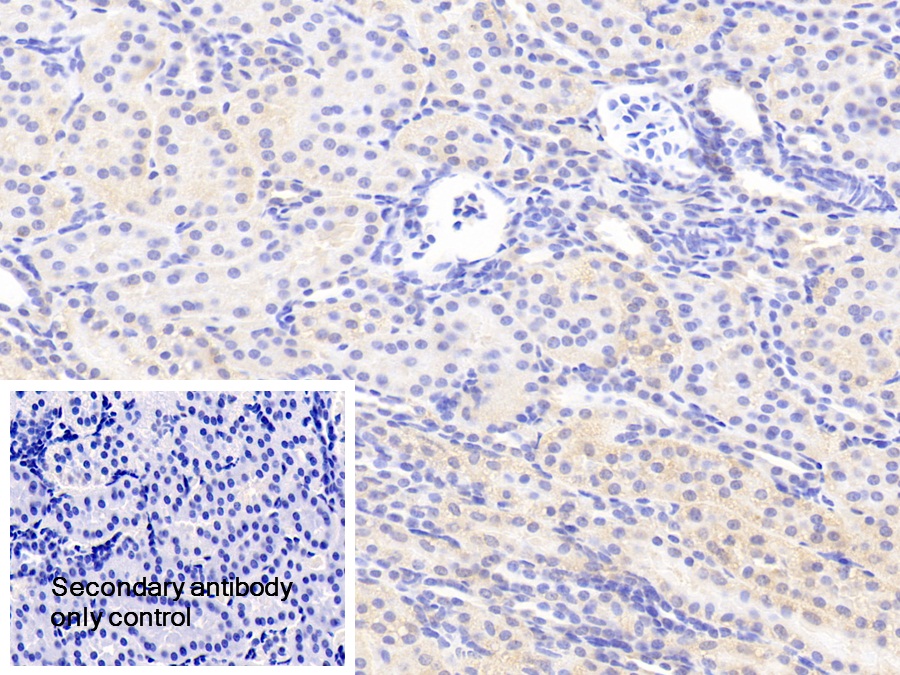 Polyclonal Antibody to c-Jun N-terminal Kinase 1 (JNK1)