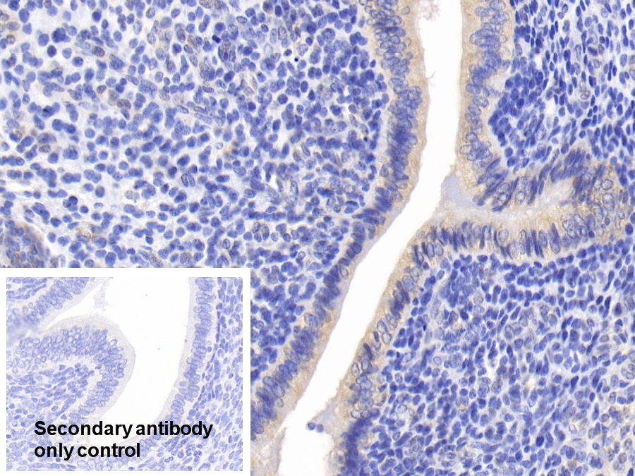 Polyclonal Antibody to c-Jun N-terminal Kinase 1 (JNK1)