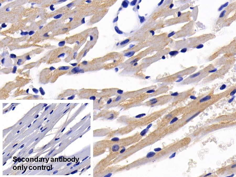 Polyclonal Antibody to c-Jun N-terminal Kinase 1 (JNK1)