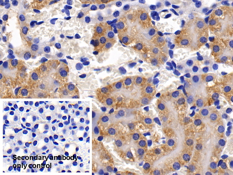 Polyclonal Antibody to c-Jun N-terminal Kinase 1 (JNK1)