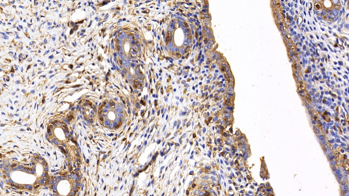 Polyclonal Antibody to c-Jun N-terminal Kinase 1 (JNK1)