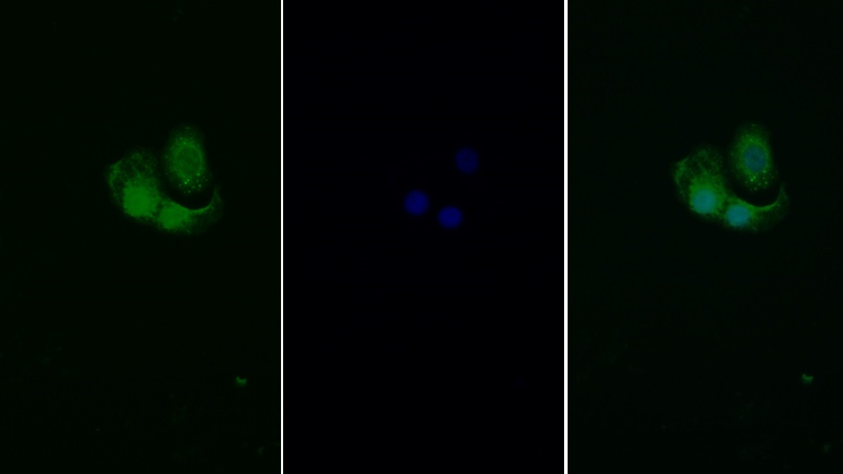 Polyclonal Antibody to c-Jun N-terminal Kinase 1 (JNK1)