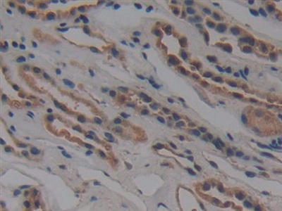 Polyclonal Antibody to Nucleoporin 155 (NUP155)