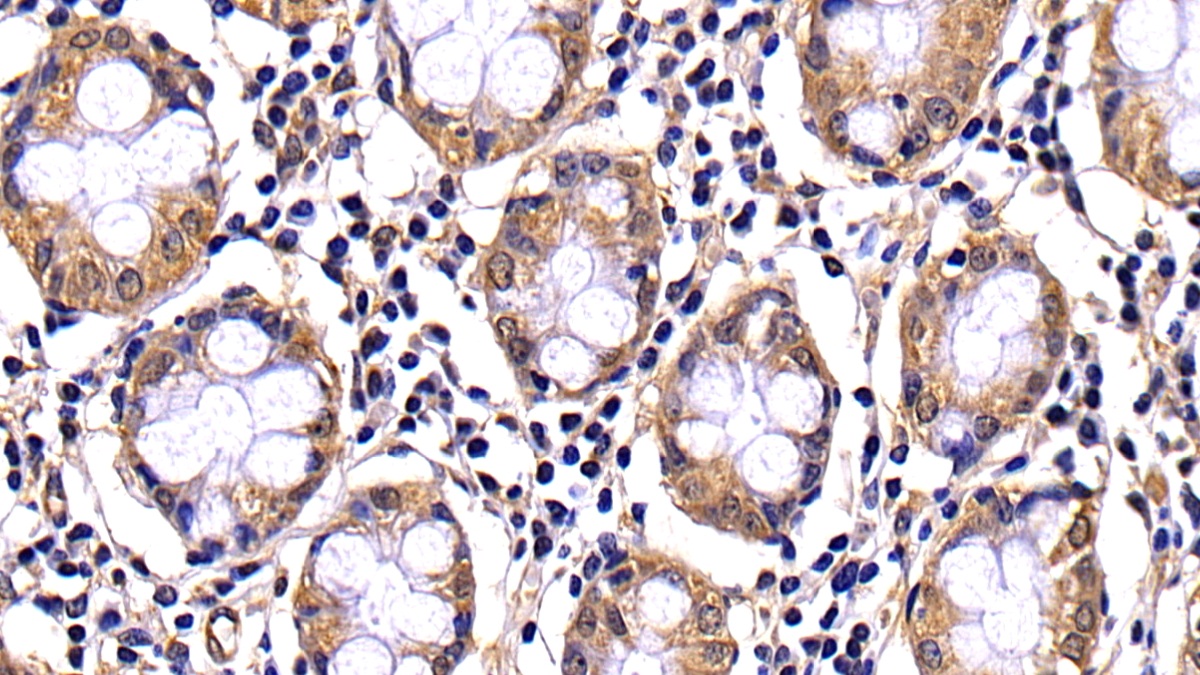 Polyclonal Antibody to Caspase 10 (CASP10)