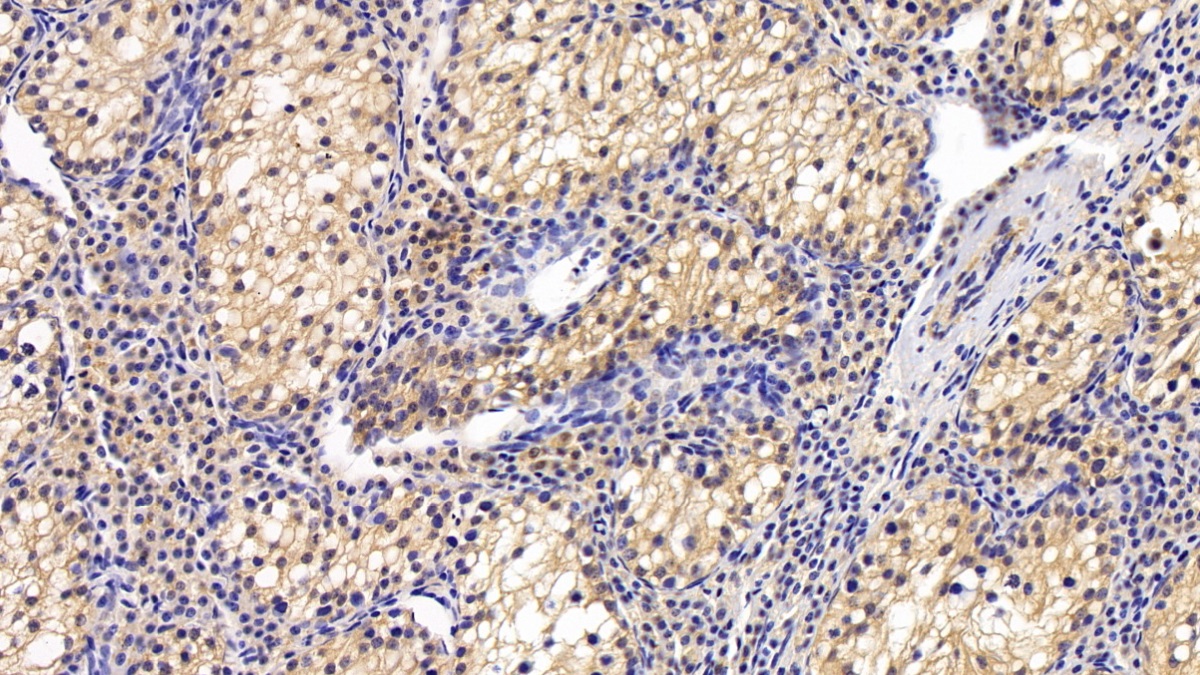 Polyclonal Antibody to Thioredoxin-interacting Protein (TXNIP)