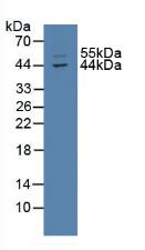 Polyclonal Antibody to Thioredoxin-interacting Protein (TXNIP)