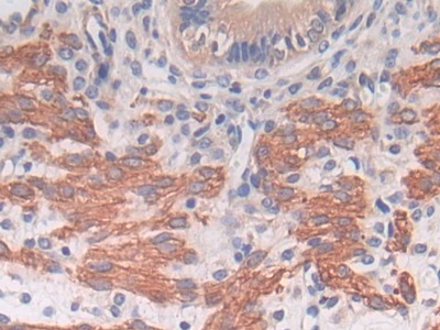 Polyclonal Antibody to Thioredoxin-interacting Protein (TXNIP)