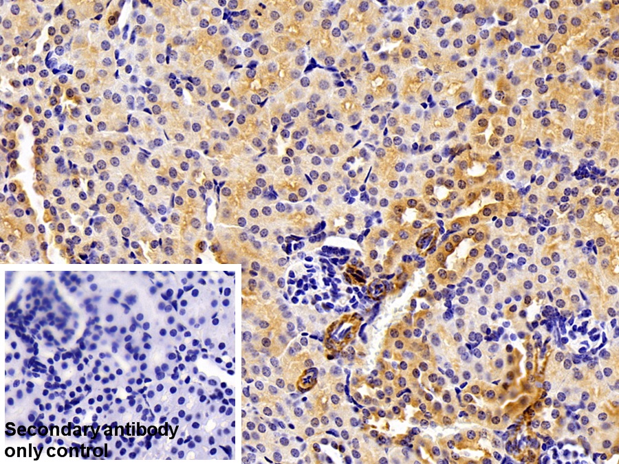 Polyclonal Antibody to Thioredoxin-interacting Protein (TXNIP)