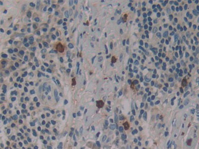 Polyclonal Antibody to Dynamin 2 (DNM2)