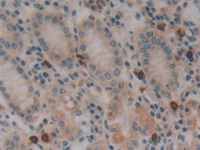 Polyclonal Antibody to Dynamin 2 (DNM2)