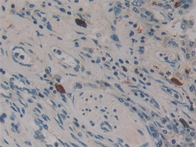 Polyclonal Antibody to Dynamin 2 (DNM2)