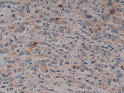 Polyclonal Antibody to Dynamin 2 (DNM2)