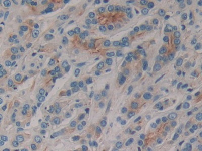 Polyclonal Antibody to Cluster Of Differentiation 1e (CD1e)