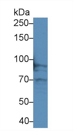 Polyclonal Antibody to Transferrin Receptor (TFR)