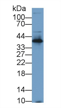 Polyclonal Antibody to Clusterin (CLU)