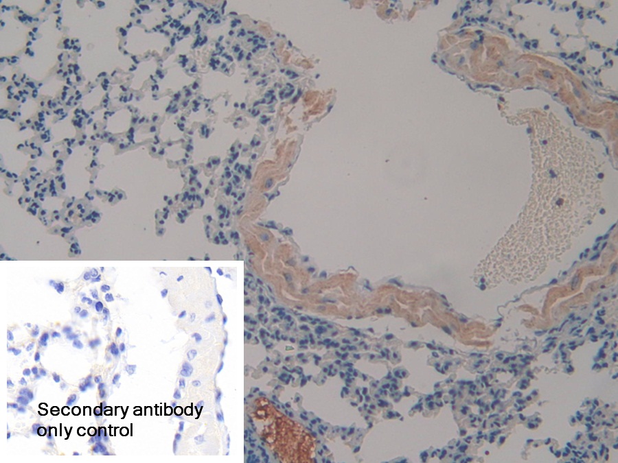 Polyclonal Antibody to Clusterin (CLU)