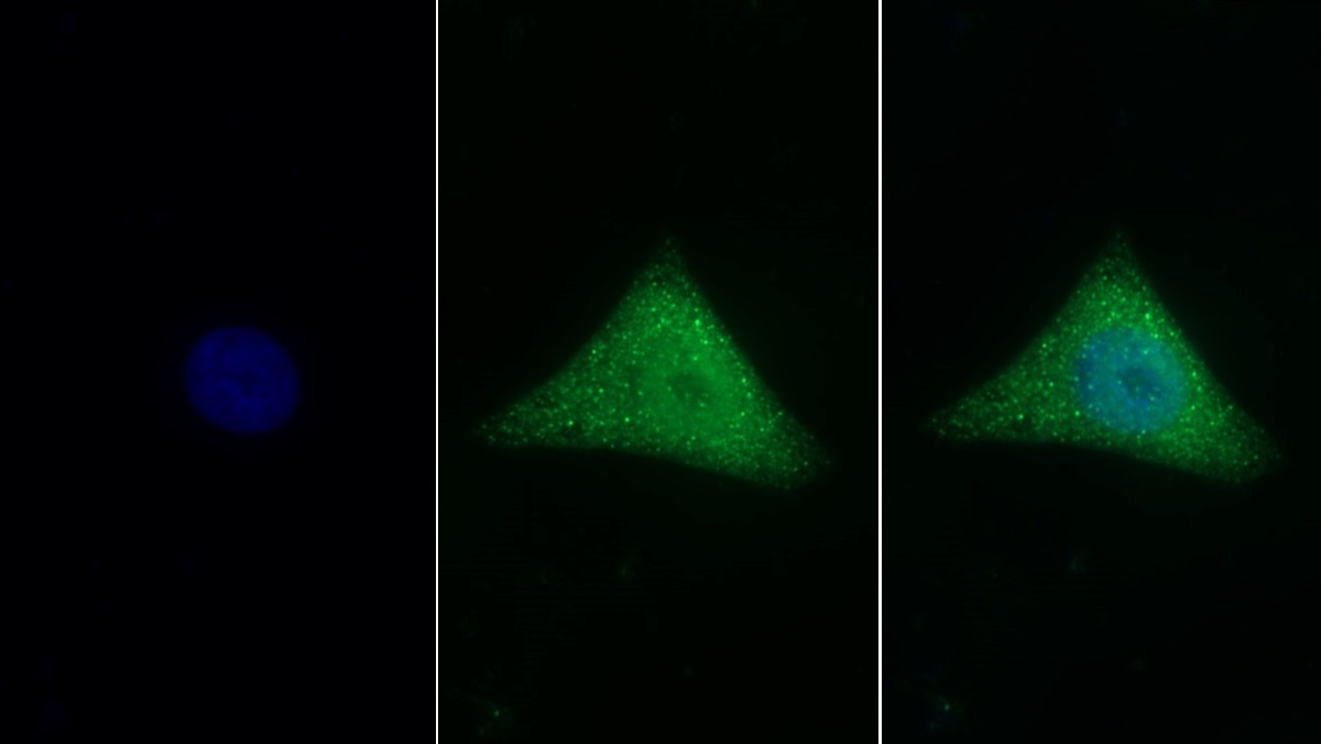 Polyclonal Antibody to Clusterin (CLU)