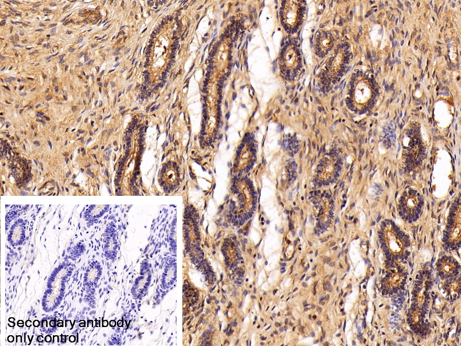 Polyclonal Antibody to Clusterin (CLU)