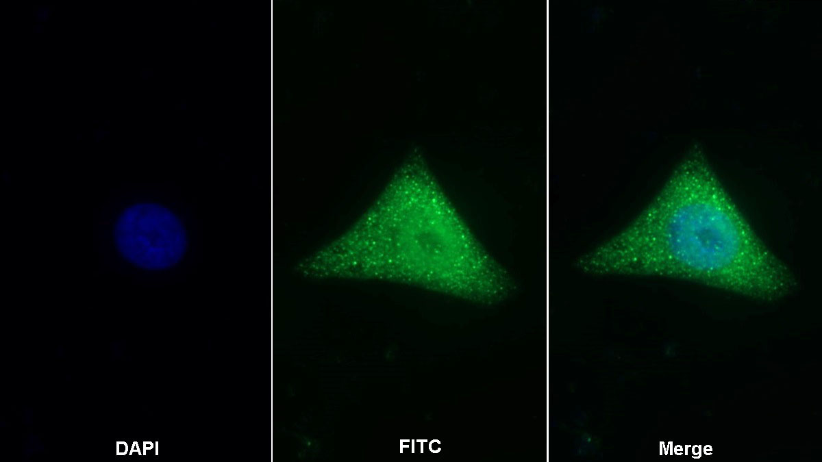 Polyclonal Antibody to Clusterin (CLU)