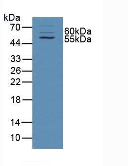 Polyclonal Antibody to Taxilin Alpha (TXLNa)