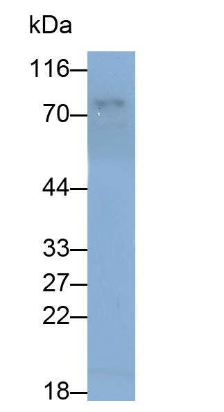 Polyclonal Antibody to Taxilin Alpha (TXLNa)