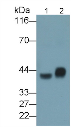 Polyclonal Antibody to Asialoglycoprotein Receptor 1 (ASGR1)