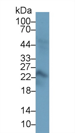 Polyclonal Antibody to Placental Lactogen (PL)