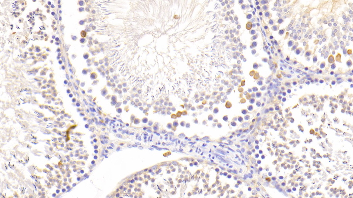 Polyclonal Antibody to Lysozyme (LZM)