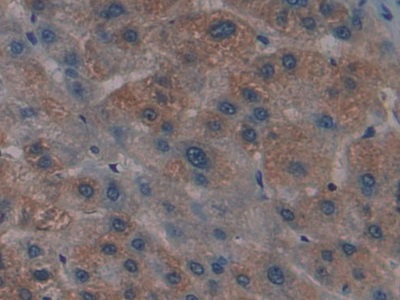 Polyclonal Antibody to Glia Maturation Factor Gamma (GMFg)