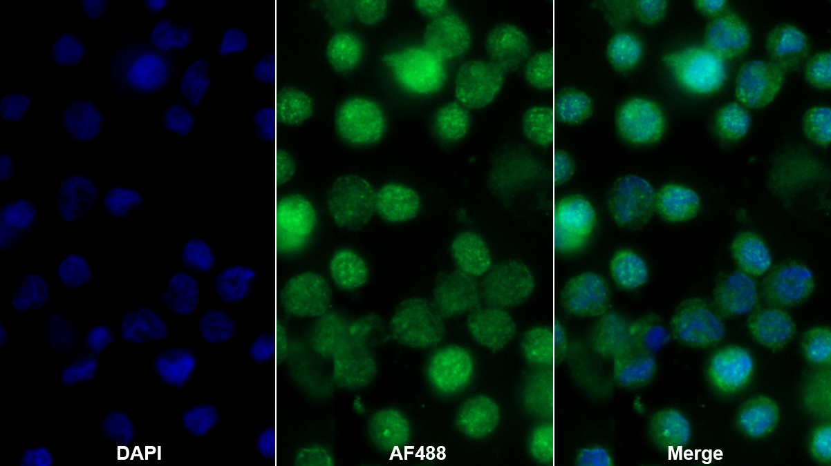 Polyclonal Antibody to Glia Maturation Factor Gamma (GMFg)