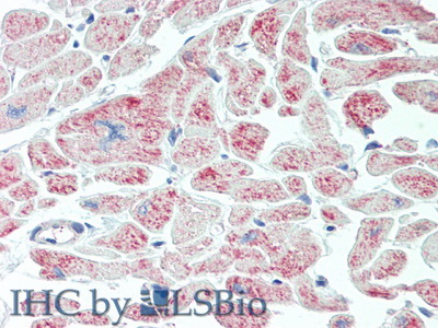 Polyclonal Antibody to Glia Maturation Factor Gamma (GMFg)